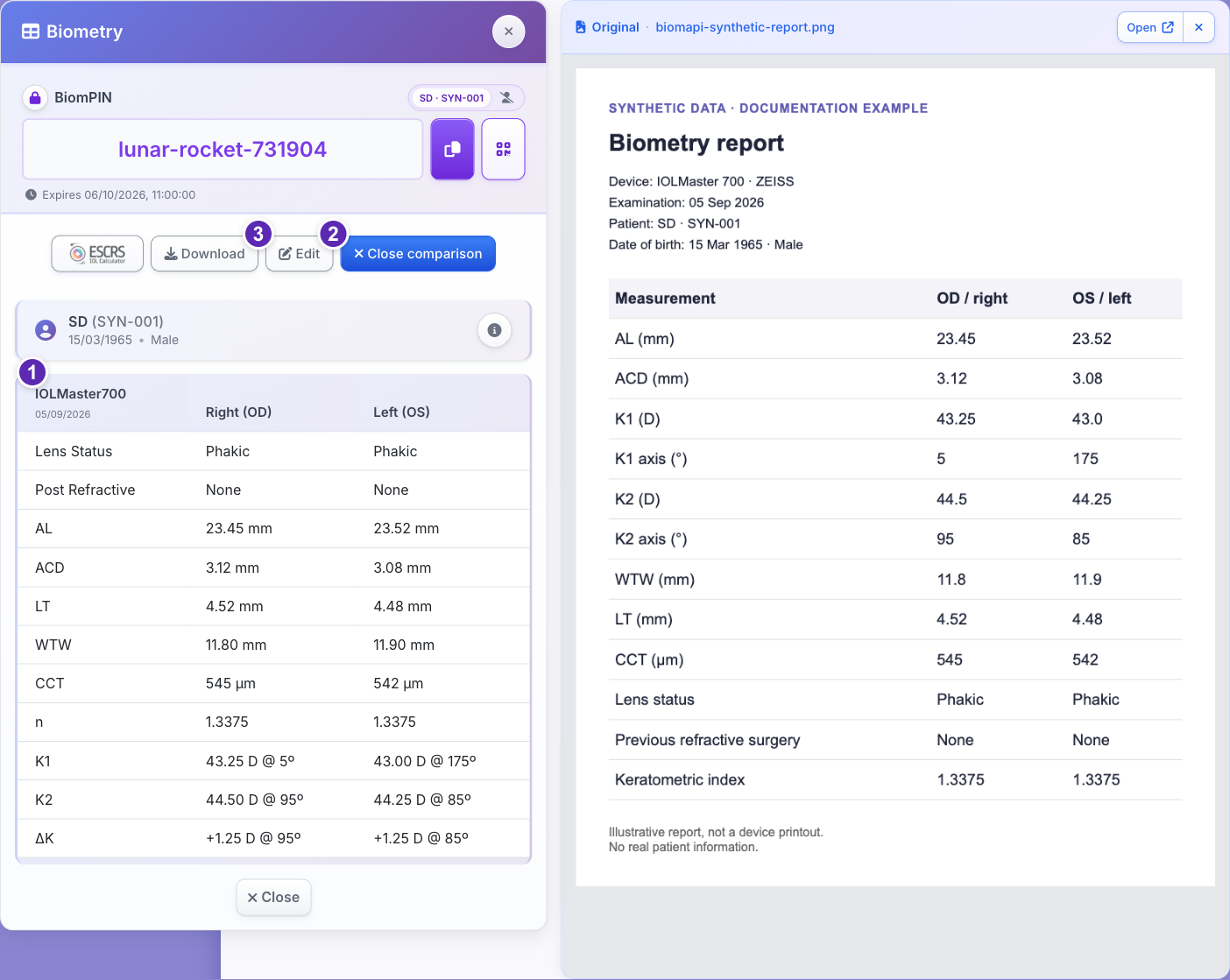 Annotated BiomAPI review with synthetic data: 1, compare OD and OS with the original; 2, use Edit to correct a value; 3, use Download to retain the reviewed JSON.
